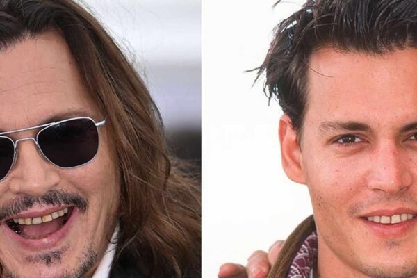 johnny depp teeth